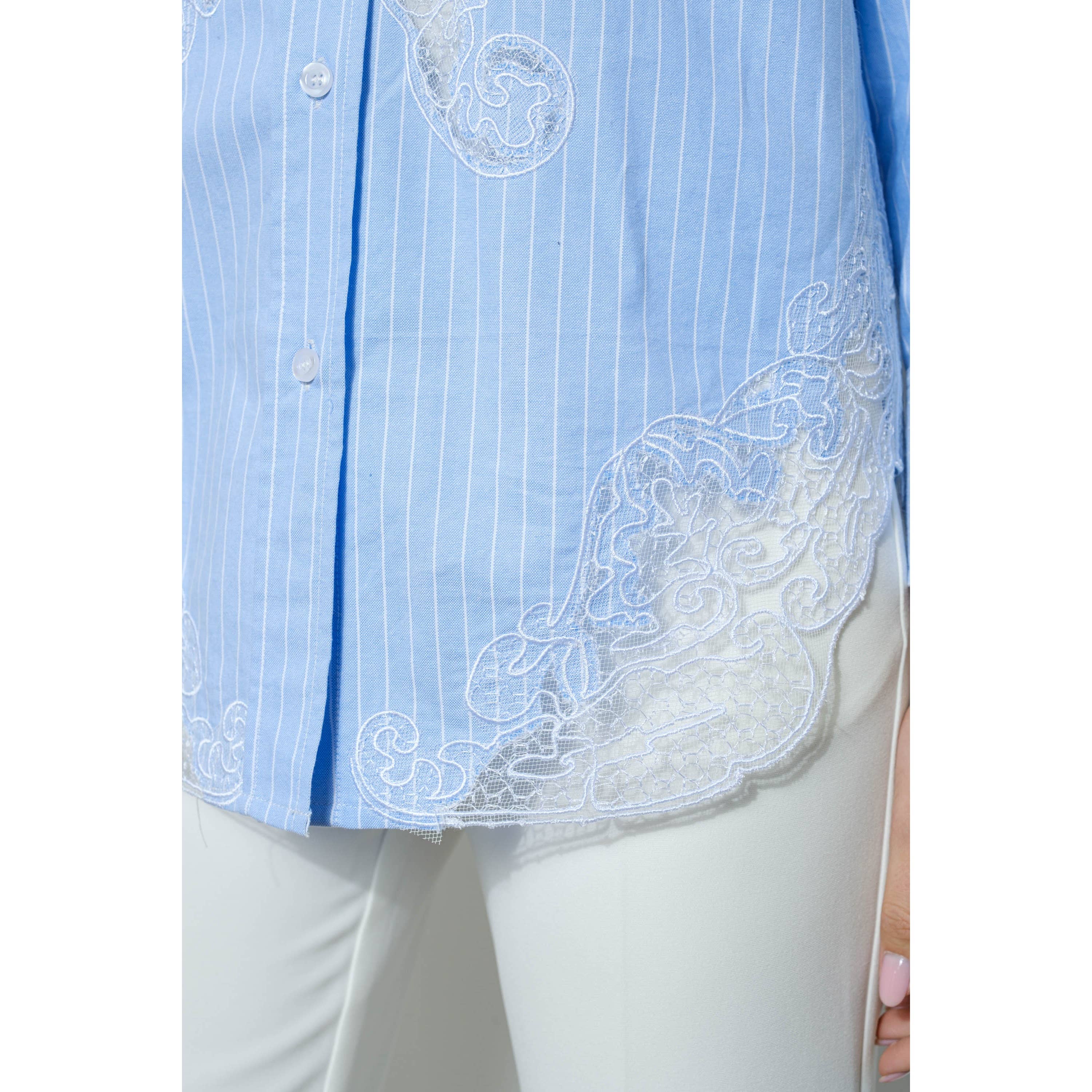 Cotton Stripe Shirt with Lace Applique